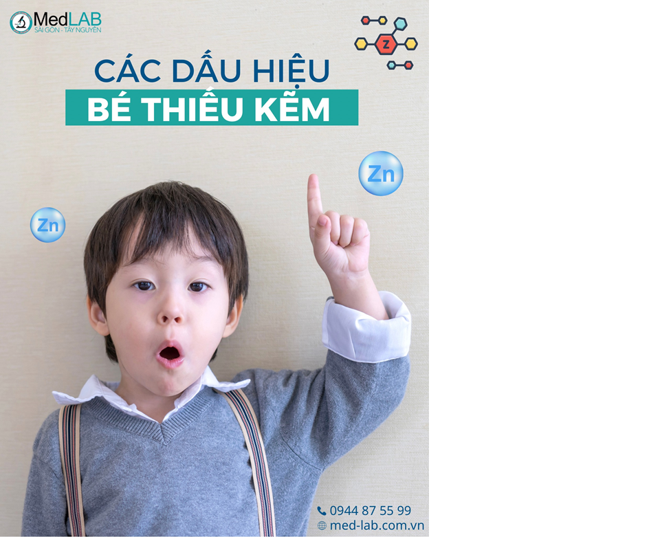 Các dấu hiệu bé thiếu kẽm (minh họa)